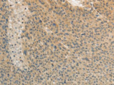 TEKT3 Antibody