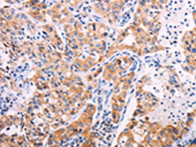 TEKT4 Antibody