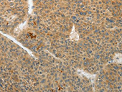 TEKT5 Antibody