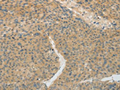TEKT5 Antibody