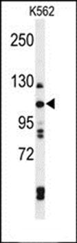 TELO2 antibody