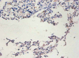 TERT Antibody