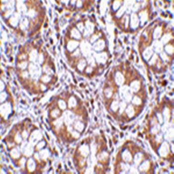 TEM2 Rabbit Polyclonal Antibody