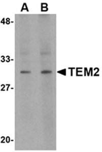 TEM2 Rabbit Polyclonal Antibody