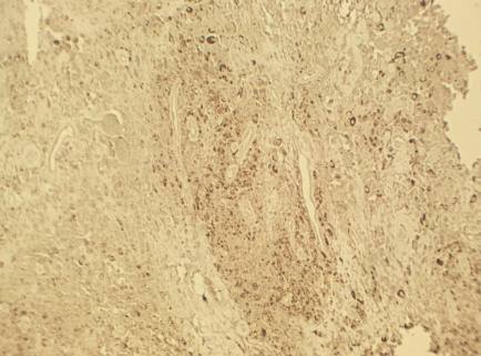 Mouse Human Tenascin Antibody