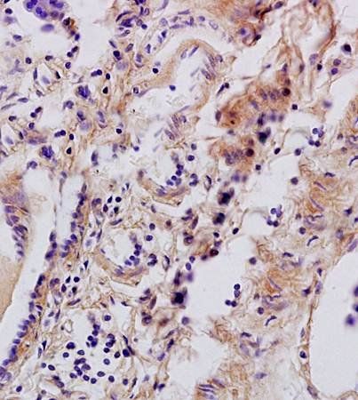Tenascin C Rabbit Polyclonal Antibody