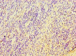 TERF2IP Antibody