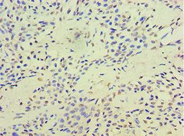 TERF2IP Antibody