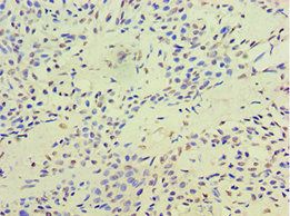 TERF2IP antibody