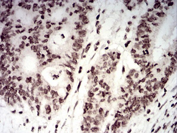 TERT Antibody