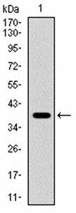 TERT Antibody