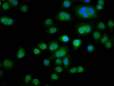 TES Antibody