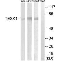 TESK1 Antibody