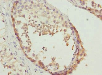 TESK2 Antibody