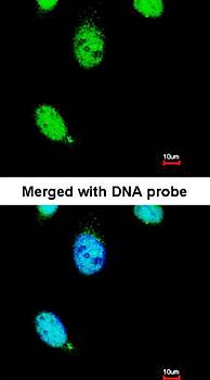 TESK2 antibody