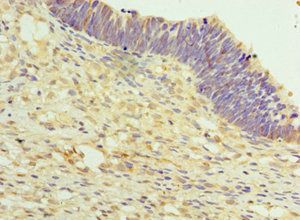 TET2 Antibody