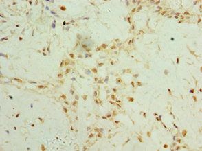 TET2 Antibody