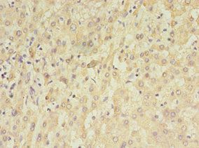TET3 Antibody
