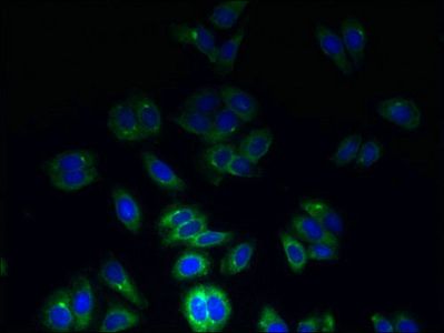 Tetraspanin-7 antibody