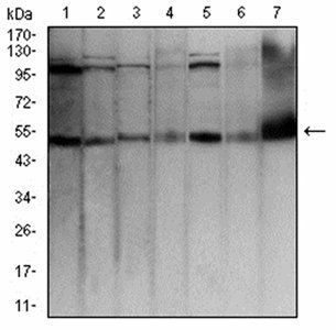 TFAP2A Antibody