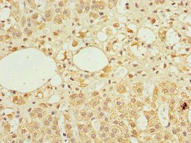 TFCP2 Antibody
