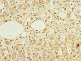 TFCP2 antibody