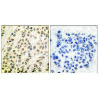 TFDP1 Antibody