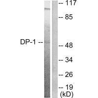 TFDP1 Antibody