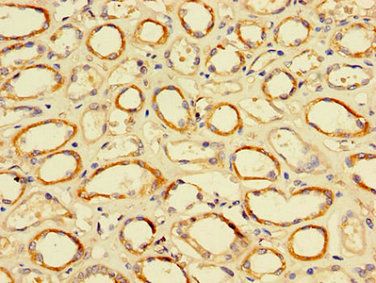 TFDP2 Antibody