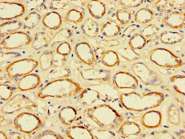 TFDP2 antibody