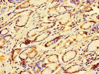 TFDP2 Antibody