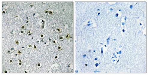 TFE3 Antibody