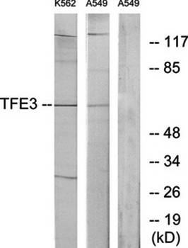 TFE3 Antibody