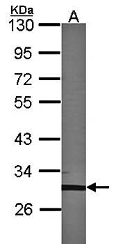TFEC Rabbit Polyclonal Antibody