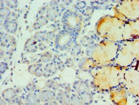 TFF1 antibody