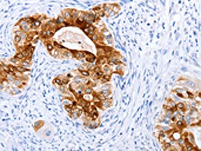 TFF1 Antibody