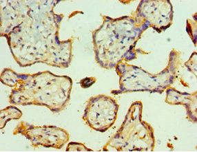 TFF2 Antibody