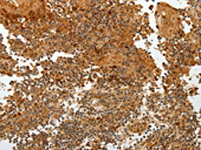 TFF2 Antibody