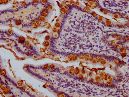 TFF3 Antibody