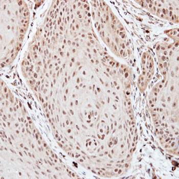TFIID (SI) antibody