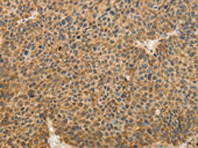 TFPI2 Antibody