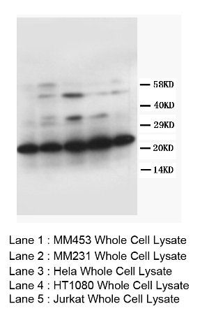 Anti-TFPI2 Antibody