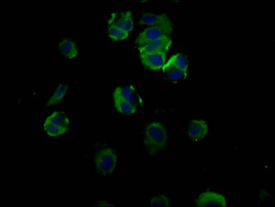 TFR2 antibody