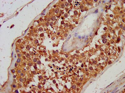 TG Antibody