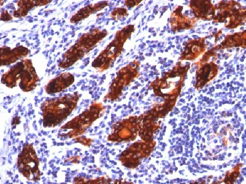 TG Antibody