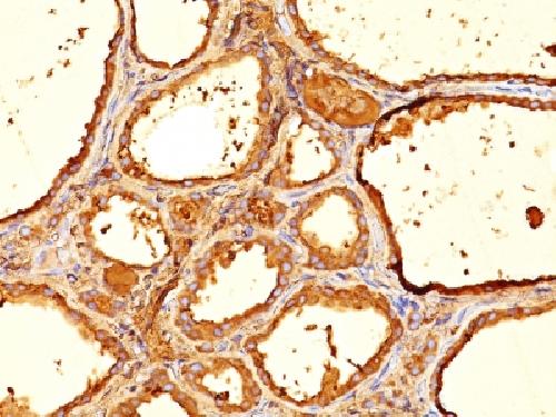 TG Antibody
