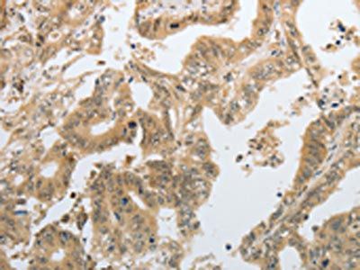 TGFB1 Antibody
