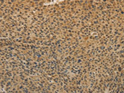 TGFB1 Antibody