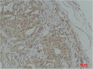 TGFB1 Antibody