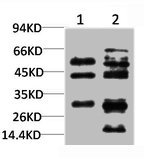 TGFB1 Antibody